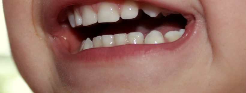 Zähne schlimme Intervallartige Zahnschmerzen