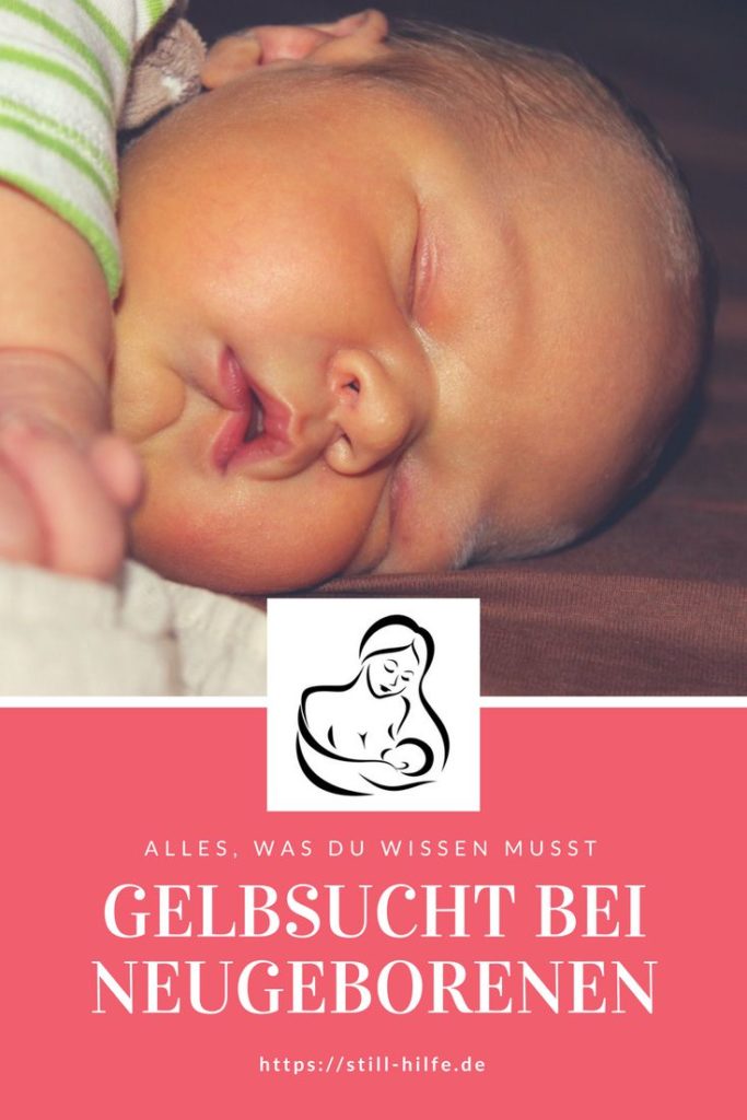 Wie gefährlich ist Gelbsucht bei Neugeborenen? | Still-Hilfe.de